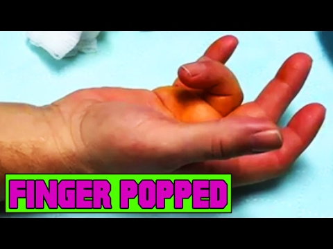 how to pop thumb